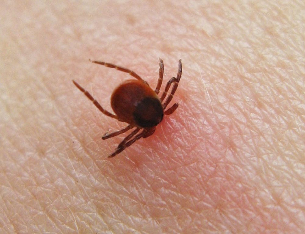 TIck Facts CAN TICKS CAUSE DEATH TO HUMANS?