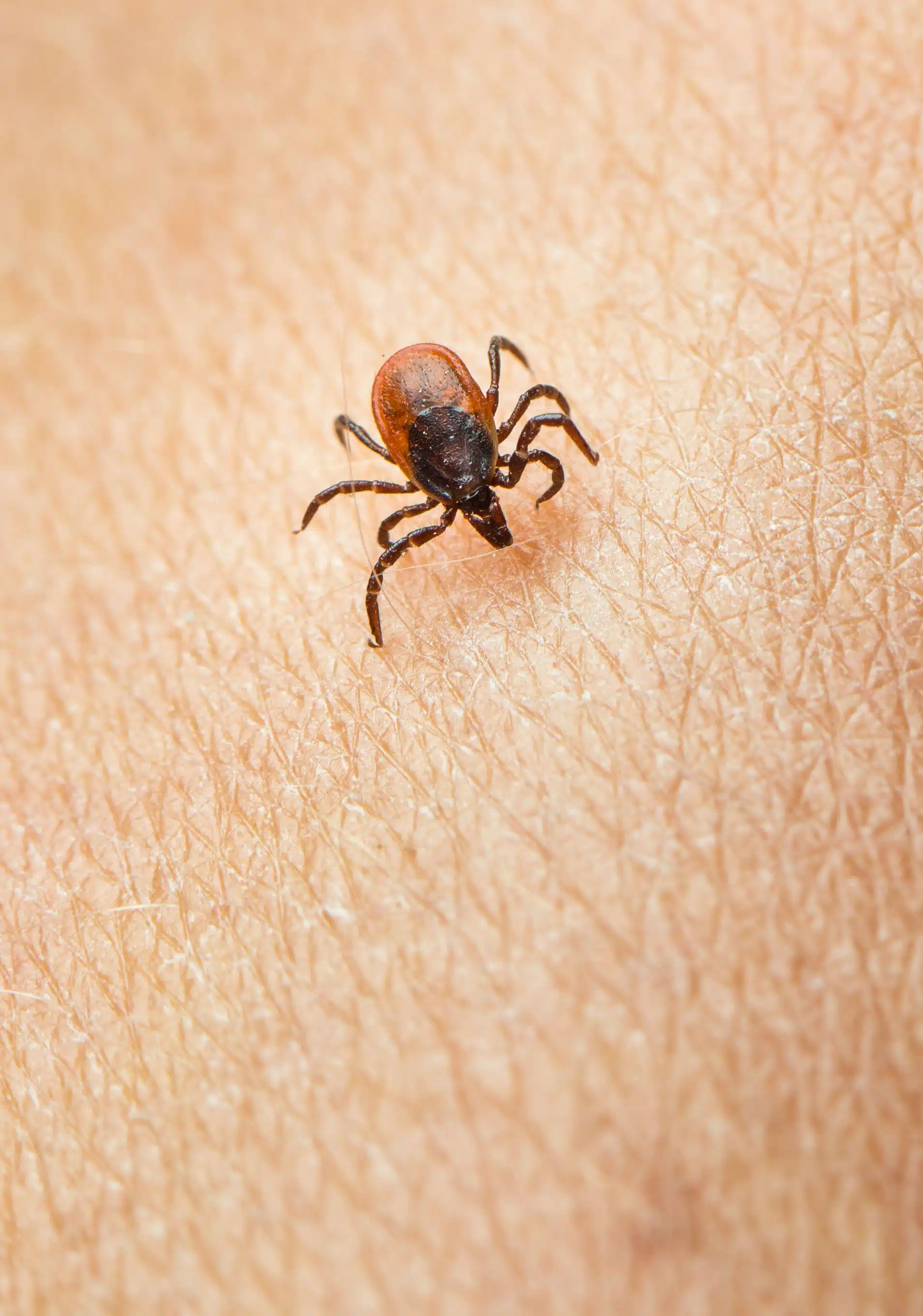 tick-control-ma-near-me